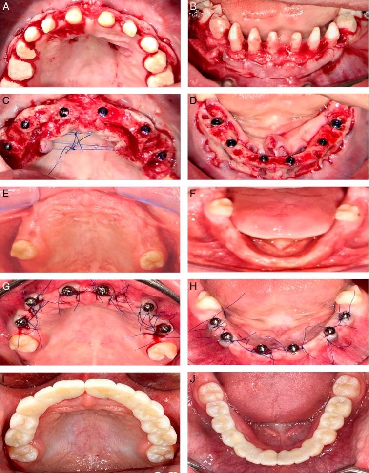 https://cdn.ncbi.nlm.nih.gov/pmc/blobs/11d7/11060206/89a7a640b296/ms9-86-3072-g005.jpg