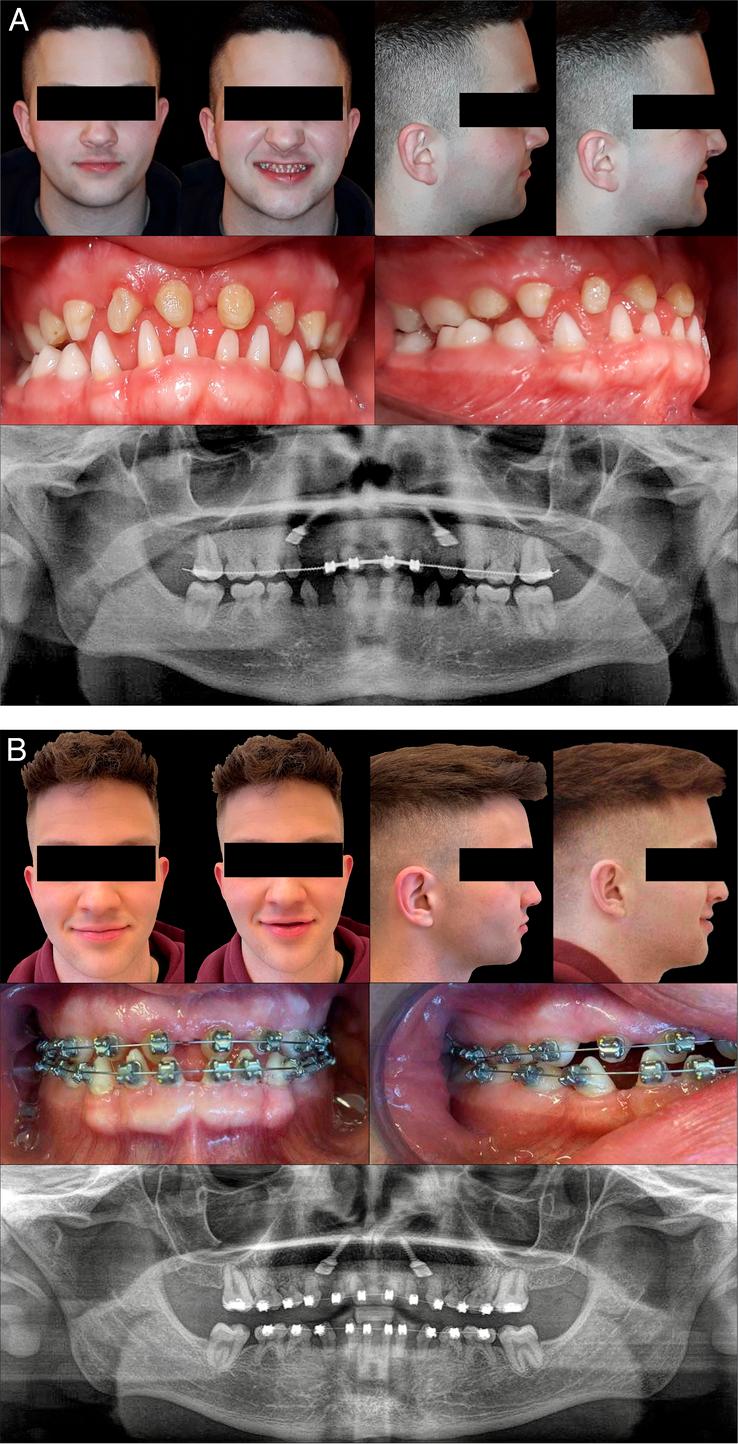 https://cdn.ncbi.nlm.nih.gov/pmc/blobs/11d7/11060206/c42869b42710/ms9-86-3072-g003.jpg