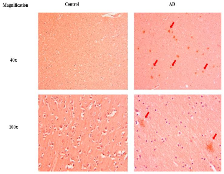 https://cdn.ncbi.nlm.nih.gov/pmc/blobs/11dd/11351951/f7514eaa3114/antioxidants-13-00926-g003.jpg
