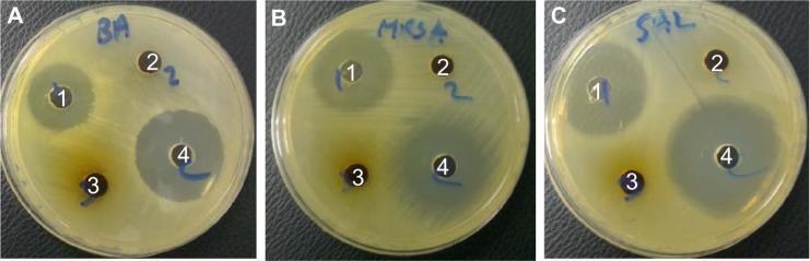 https://cdn.ncbi.nlm.nih.gov/pmc/blobs/11de/3890966/67d1415bcecb/ijn-9-351Fig9.jpg