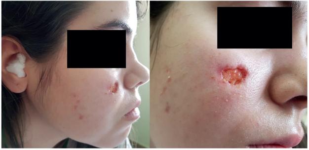 https://cdn.ncbi.nlm.nih.gov/pmc/blobs/11e0/9137391/f9182352969a/ActaDV-100-10-5761-g001.jpg