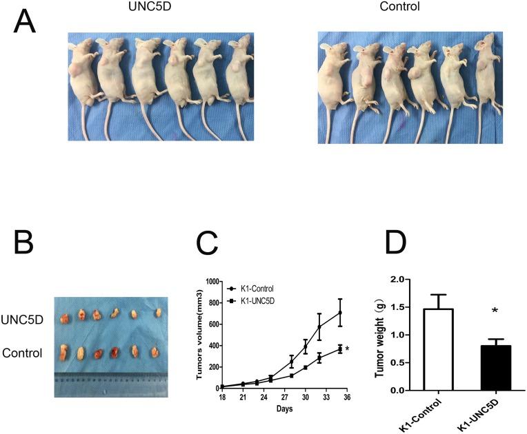 https://cdn.ncbi.nlm.nih.gov/pmc/blobs/11e2/5707086/c14ccb0fc1bf/oncotarget-08-96126-g005.jpg