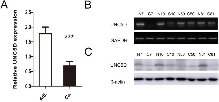 https://cdn.ncbi.nlm.nih.gov/pmc/blobs/11e2/5707086/ce8e7e02507f/oncotarget-08-96126-g001.jpg