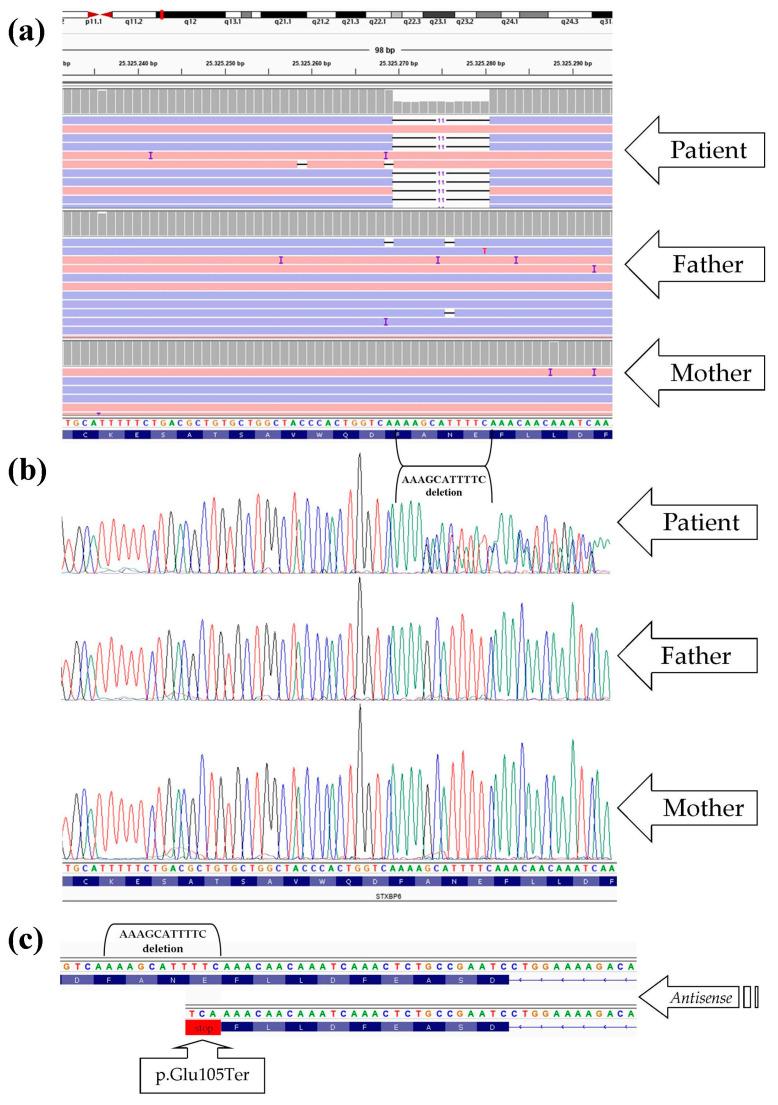 https://cdn.ncbi.nlm.nih.gov/pmc/blobs/11e8/10670990/d6b8650ed3cd/ijms-24-16436-g004.jpg