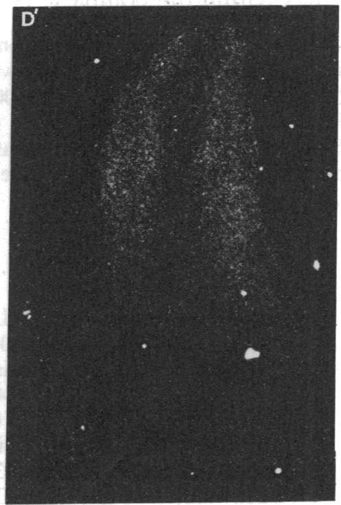 https://cdn.ncbi.nlm.nih.gov/pmc/blobs/11f2/281803/104cb9d80c88/pnas00294-0249-e.jpg
