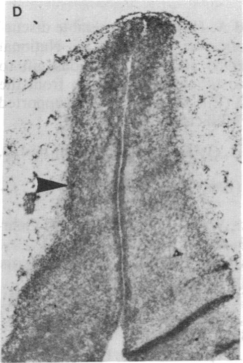 https://cdn.ncbi.nlm.nih.gov/pmc/blobs/11f2/281803/ce8ba2a758d8/pnas00294-0249-g.jpg