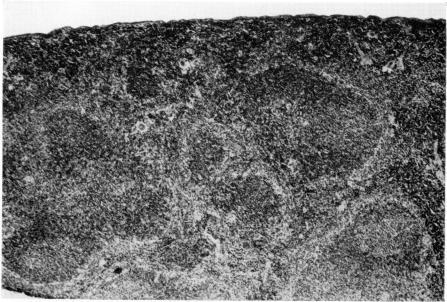 https://cdn.ncbi.nlm.nih.gov/pmc/blobs/11f5/1578972/2efdd95691e1/clinexpimmunol00351-0052-a.jpg