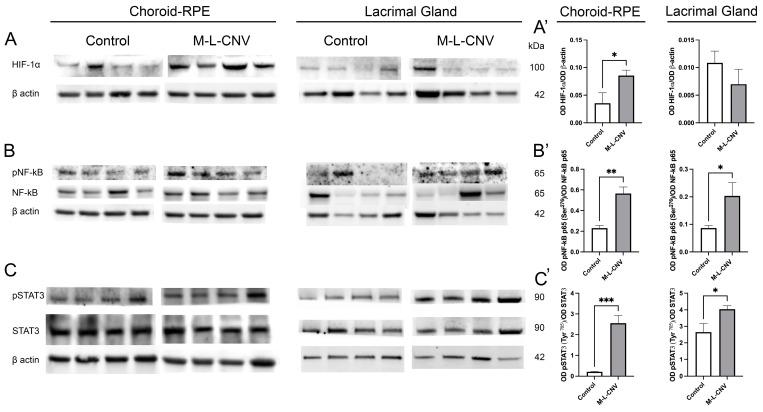 https://cdn.ncbi.nlm.nih.gov/pmc/blobs/11f7/12027898/2feb7702ea5f/ijms-26-03855-g003.jpg