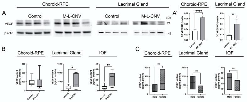 https://cdn.ncbi.nlm.nih.gov/pmc/blobs/11f7/12027898/75135bdb438f/ijms-26-03855-g002.jpg