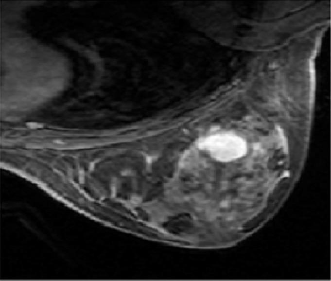 https://cdn.ncbi.nlm.nih.gov/pmc/blobs/11fb/6025760/6af663cde779/JMAU-5-59-g011.jpg