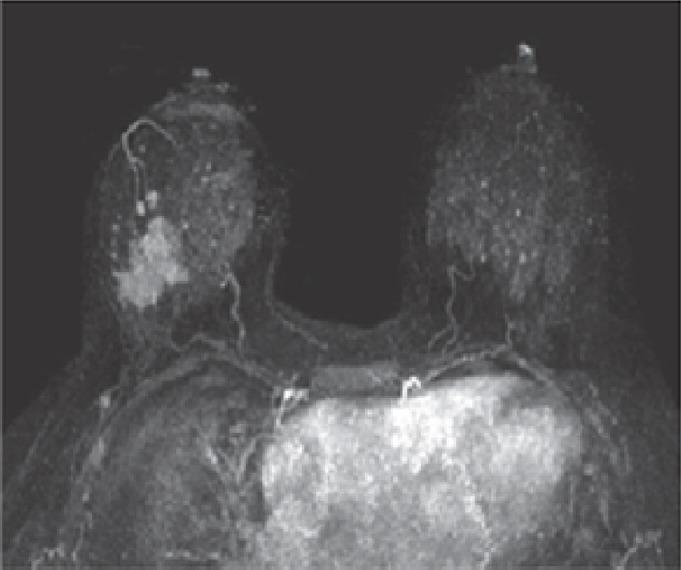 https://cdn.ncbi.nlm.nih.gov/pmc/blobs/11fb/6025760/6b9c258dce85/JMAU-5-59-g012.jpg