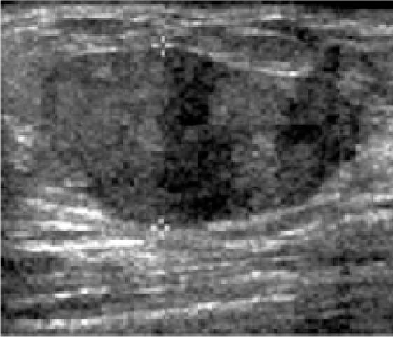 https://cdn.ncbi.nlm.nih.gov/pmc/blobs/11fb/6025760/cb24f57985c1/JMAU-5-59-g009.jpg