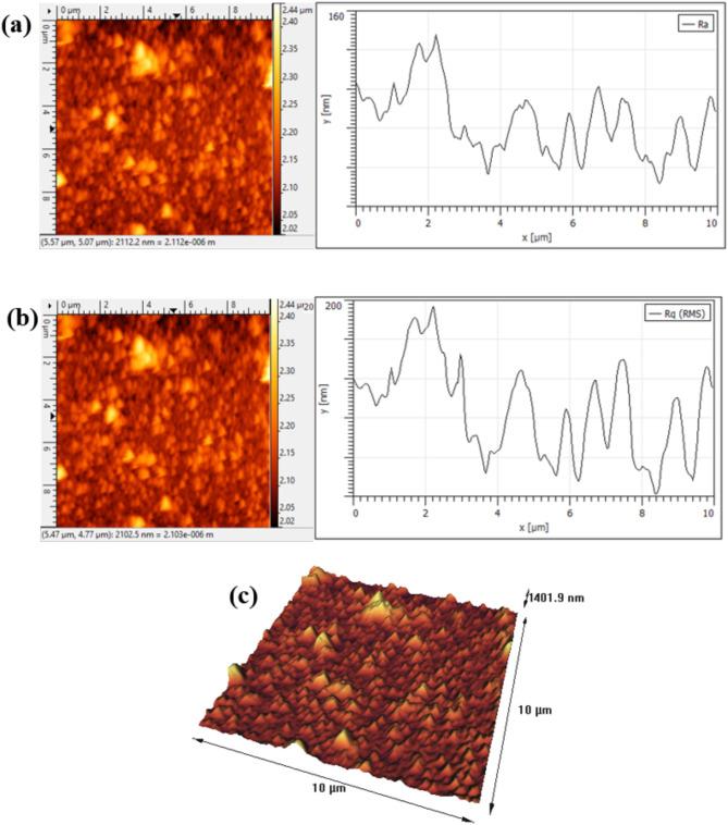 https://cdn.ncbi.nlm.nih.gov/pmc/blobs/1201/11873253/018f33f30787/41598_2025_92246_Fig2_HTML.jpg