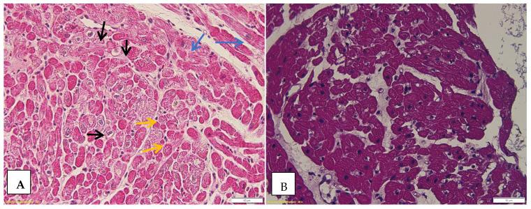https://cdn.ncbi.nlm.nih.gov/pmc/blobs/1202/11505139/6191ffcd9cbf/biomedicines-12-02258-g005.jpg