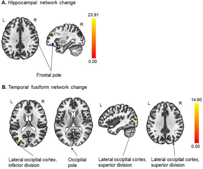 https://cdn.ncbi.nlm.nih.gov/pmc/blobs/1213/11577984/936d54d66437/PSYG-24-1075-g002.jpg