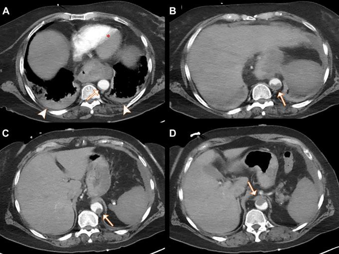 https://cdn.ncbi.nlm.nih.gov/pmc/blobs/1216/8630533/0f3ea9599fc6/radiol.2021210777.fig3.jpg