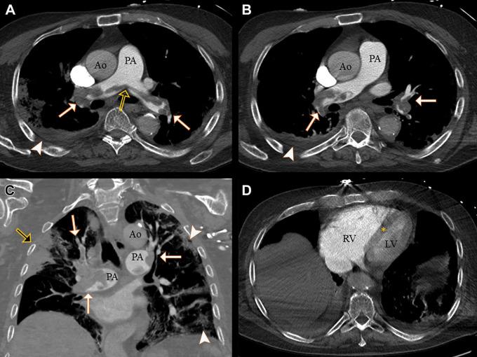 https://cdn.ncbi.nlm.nih.gov/pmc/blobs/1216/8630533/753143cb64df/radiol.2021210777.fig2.jpg