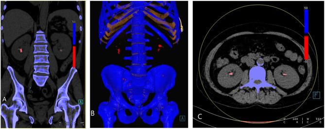 https://cdn.ncbi.nlm.nih.gov/pmc/blobs/1217/8212931/9358849ff445/fmed-08-649505-g0002.jpg