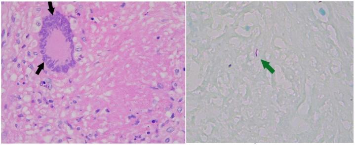 https://cdn.ncbi.nlm.nih.gov/pmc/blobs/1217/8379431/82ac1cb8fa63/gr3.jpg
