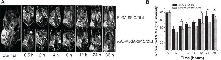 https://cdn.ncbi.nlm.nih.gov/pmc/blobs/121a/3415325/bd8b0c12eebb/ijn-7-4037f6.jpg