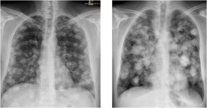 https://cdn.ncbi.nlm.nih.gov/pmc/blobs/1222/6474390/8cc2b6e8e433/fendo-10-00218-g0001.jpg