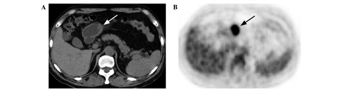 https://cdn.ncbi.nlm.nih.gov/pmc/blobs/1229/4156241/fc8ad814c36c/OL-08-04-1757-g02.jpg