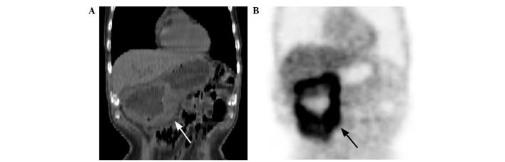 https://cdn.ncbi.nlm.nih.gov/pmc/blobs/1229/4156241/fd0ca67499f5/OL-08-04-1757-g00.jpg
