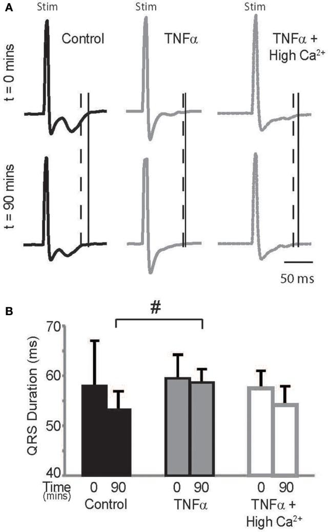 https://cdn.ncbi.nlm.nih.gov/pmc/blobs/1229/5440594/847ac3d56c41/fphys-08-00334-g0005.jpg