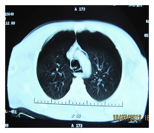 https://cdn.ncbi.nlm.nih.gov/pmc/blobs/122e/3542916/137c1c04b0f7/CRIM.EM2012-242579.001.jpg