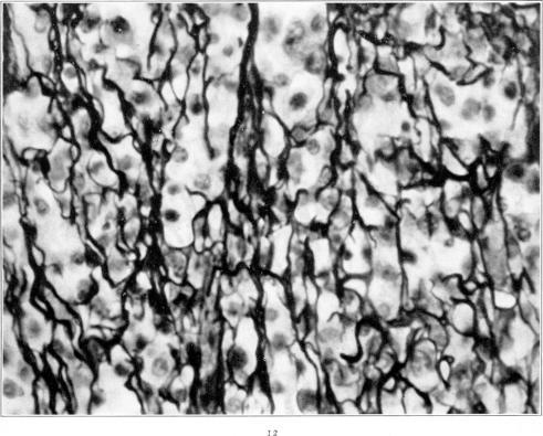 https://cdn.ncbi.nlm.nih.gov/pmc/blobs/1232/2062869/04ca551d8eb2/amjpathol00710-0036-b.jpg