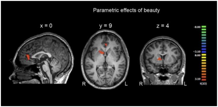 https://cdn.ncbi.nlm.nih.gov/pmc/blobs/123b/4399337/b97eff091a6e/fnhum-09-00186-g0005.jpg