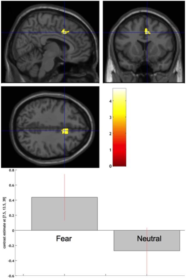 https://cdn.ncbi.nlm.nih.gov/pmc/blobs/123b/4399337/c471f94a30b0/fnhum-09-00186-g0004.jpg