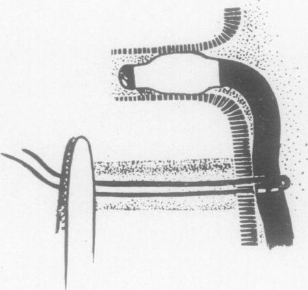 https://cdn.ncbi.nlm.nih.gov/pmc/blobs/123d/1018848/b1da10fd0b7e/thorax00076-0085-b.jpg