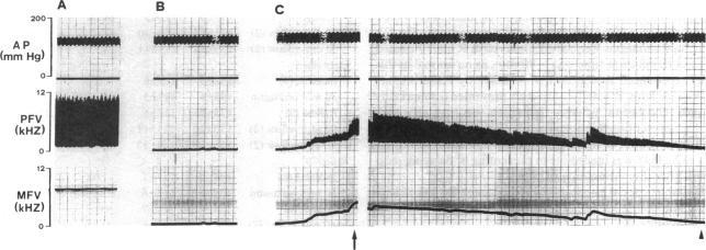 https://cdn.ncbi.nlm.nih.gov/pmc/blobs/123f/296837/b1c82f505703/jcinvest00076-0089-a.jpg