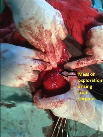 https://cdn.ncbi.nlm.nih.gov/pmc/blobs/1249/5532906/e29ac8e47b9f/UA-9-301-g003.jpg