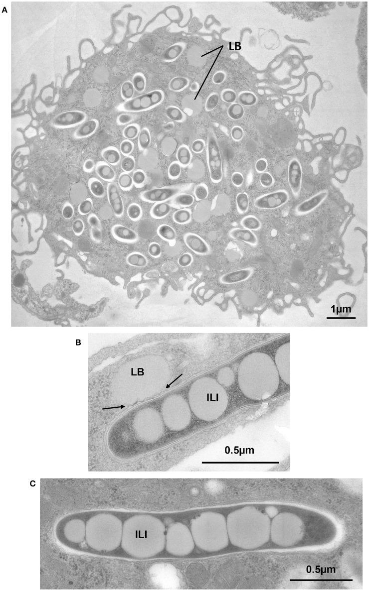 https://cdn.ncbi.nlm.nih.gov/pmc/blobs/124a/5054039/2e9e0a58d343/fcimb-06-00122-g0004.jpg