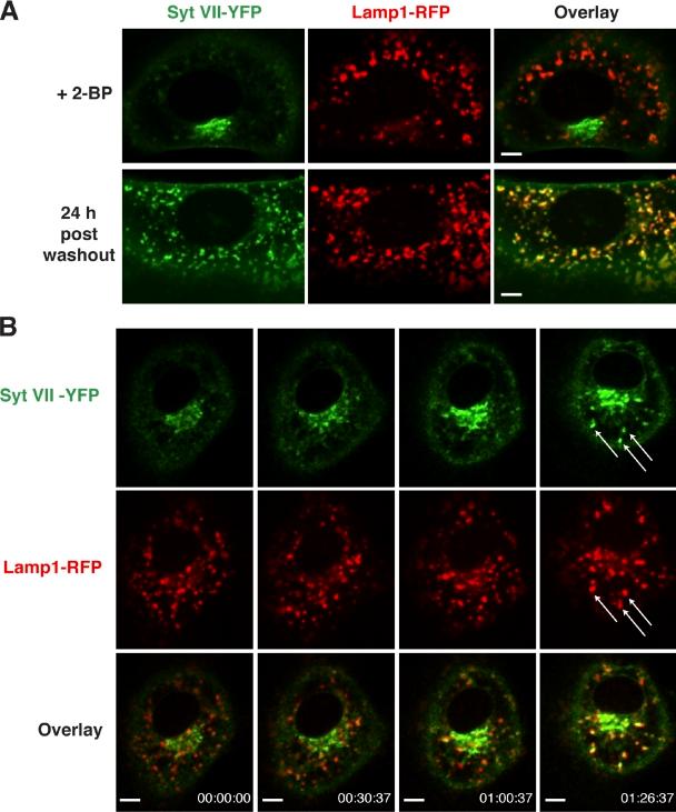 https://cdn.ncbi.nlm.nih.gov/pmc/blobs/124b/3003310/568607da1873/JCB_201003021_RGB_Fig6.jpg