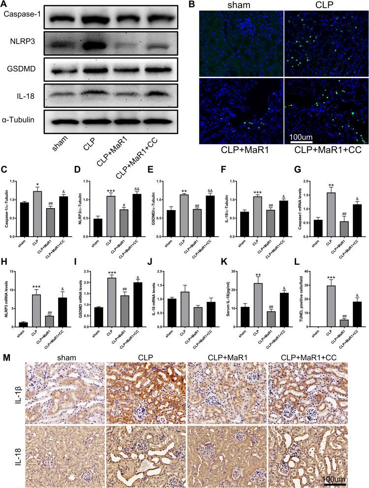 https://cdn.ncbi.nlm.nih.gov/pmc/blobs/1253/10908291/1e9a0aee3276/JIR-17-1349-g0007.jpg