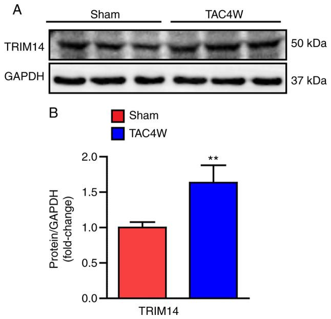 https://cdn.ncbi.nlm.nih.gov/pmc/blobs/1255/10433706/7ef8973e2d2a/mmr-28-03-13060-g00.jpg