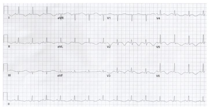 https://cdn.ncbi.nlm.nih.gov/pmc/blobs/1257/6199886/9bc13000b3ee/CRIEM2018-5023954.002.jpg