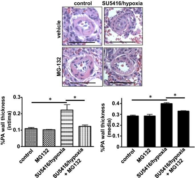 https://cdn.ncbi.nlm.nih.gov/pmc/blobs/125b/3959719/2101f9a10906/jah3-3-e000520-g4.jpg