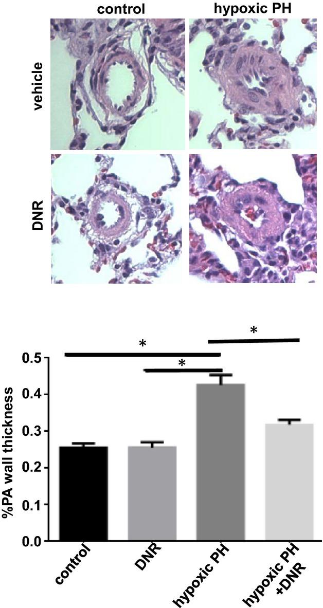 https://cdn.ncbi.nlm.nih.gov/pmc/blobs/125b/3959719/ff6f07da483b/jah3-3-e000520-g3.jpg