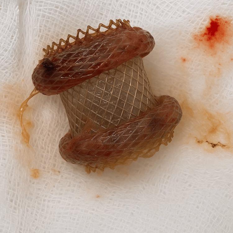 https://cdn.ncbi.nlm.nih.gov/pmc/blobs/125e/12288431/0d1f39a5a46b/cureus-0017-00000086650-i07.jpg