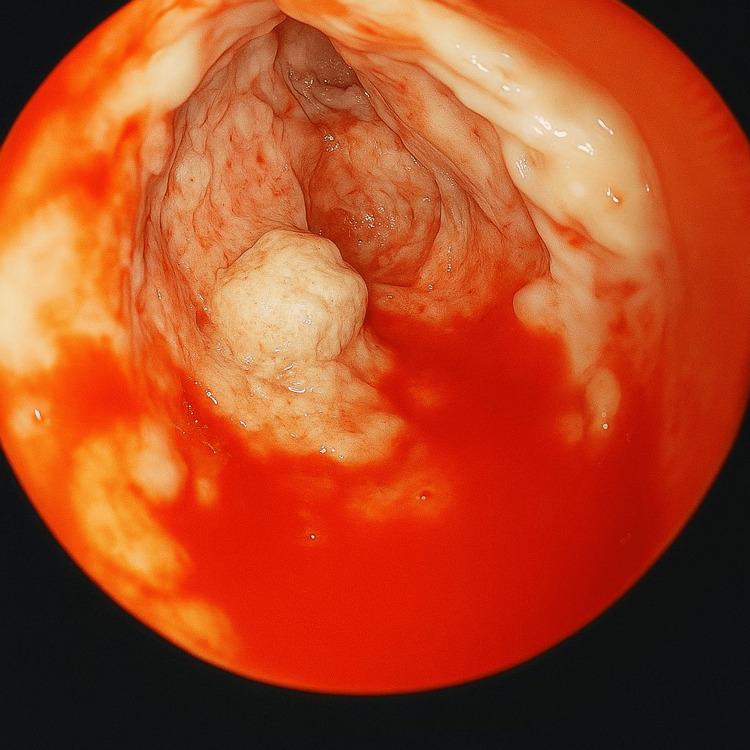 https://cdn.ncbi.nlm.nih.gov/pmc/blobs/125e/12288431/e3812a9e3e11/cureus-0017-00000086650-i06.jpg