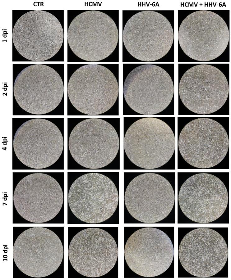 https://cdn.ncbi.nlm.nih.gov/pmc/blobs/1261/9415275/945772c55627/microorganisms-10-01600-g001.jpg