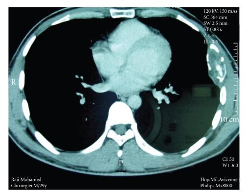 https://cdn.ncbi.nlm.nih.gov/pmc/blobs/1262/2825664/7691bf8eec7e/CRM2009-817205.002.jpg