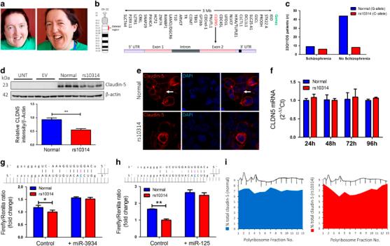 https://cdn.ncbi.nlm.nih.gov/pmc/blobs/1262/6298981/7aa7b9975793/41380_2018_149_Fig1_HTML.jpg