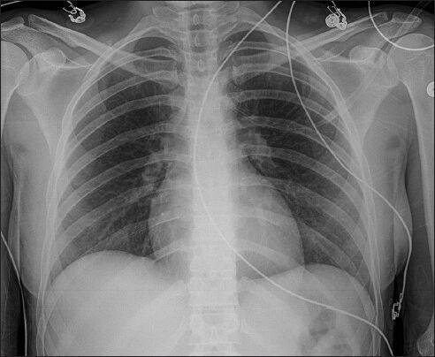 https://cdn.ncbi.nlm.nih.gov/pmc/blobs/1265/3982377/d292e058871b/IJCIIS-4-91-g001.jpg