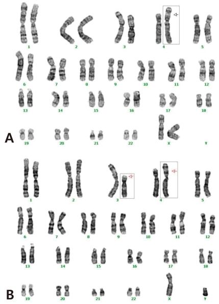 https://cdn.ncbi.nlm.nih.gov/pmc/blobs/126d/3315620/040d539516cf/kjped-55-107-g004.jpg