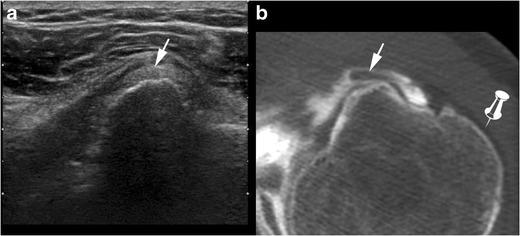 https://cdn.ncbi.nlm.nih.gov/pmc/blobs/1270/5110480/0ac906aa9440/13244_2016_526_Fig12_HTML.jpg